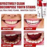Yayashi SP-4 Ultra Whitening Toothpaste | Stain Remover & Fresh Breath Formula view 4