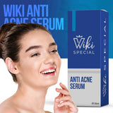 Wiki Special Anti Acne Serum 30ml | Clears Acne & Soothes Skin view 2