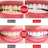 Yayashi SP-4 Ultra Whitening Toothpaste | Stain Remover & Fresh Breath Formula view 2