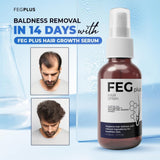 FEG Plus Hair Growth Spray 50ml | Anti-Hair Loss & Regrowth Solution view 4