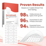 DermaSmooth Skin Tag Remover Patch |  Fast, Safe & Painless Skin Tag & Mole Removal | Nano-Microneedle Technology | 72 Patches view 2