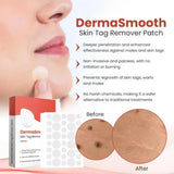 DermaSmooth Skin Tag Remover Patch |  Fast, Safe & Painless Skin Tag & Mole Removal | Nano-Microneedle Technology | 72 Patches view 3