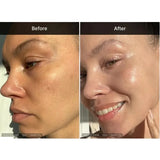 Medicube Deep Vita C Capsule Cream | Brightening Vitamin C Moisturizer view 3