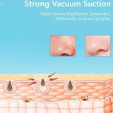 Rechargeable Blackhead Remover Vacuum Cleaner | Model FPLS-001 | Deep Pore Cleansing & Microdermabrasion Device view 6