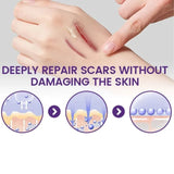 TIMILK Scarvanisher Scar Gel 30g | Advanced Scar & Stretch Marks Removal Cream | Fast-Absorbing Skin Repair Gel view 2