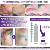 TIMILK Scarvanisher Scar Gel 30g | Advanced Scar & Stretch Marks Removal Cream | Fast-Absorbing Skin Repair Gel view 4