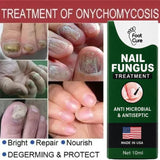 Fast Nail Fungus Treatment Serum | Nail Repair Essence for Fingernails & Toenails | Natural Nail Care Formula view 2