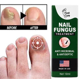 Fast Nail Fungus Treatment Serum | Nail Repair Essence for Fingernails & Toenails | Natural Nail Care Formula view 3