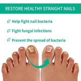 Fast Nail Fungus Treatment Serum | Nail Repair Essence for Fingernails & Toenails | Natural Nail Care Formula view 6