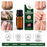 Fast Nail Fungus Treatment Serum | Nail Repair Essence for Fingernails & Toenails | Natural Nail Care Formula view 1