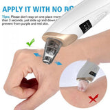 Blackhead Suction Remover Portable Pore Cleaner with LED Display and Multiple Suction Levels view 5