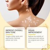 Vitigo Bee Venom Treatment Cream | Natural Skin Repair Hydration Relief Anti-Irritation view 3
