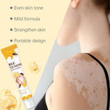Vitigo Bee Venom Treatment Cream | Natural Skin Repair Hydration Relief Anti-Irritation view 6