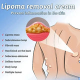 Lipoma Removal  Cream | Herbal Skin Care Cream for Smooth & Nourished Skin | Fast-Absorbing Formula | For Neck & Body | 50g view 5