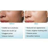 Pilgrim Peeling Solution | Weekend Facial Peel for Deep Cleansing & Exfoliation | Radiant & Even-Toned Skin | For Men & Women | 30ml view 6