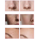 Arbutin 7% + Tranexamic Acid 4% Cream | Brightening Moisturizer for Dark Spots, Uneven Tone & Hydration | 50g view 5